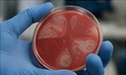 What Every MedTech Should Know About Blood Culture Collection